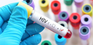 Czas się zbadać w kierunku HIV [Plakat]